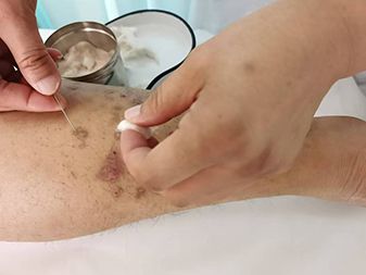 优 秀学员事例（潍坊奎文区陈爱菊）