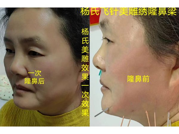 杨氏美雕专业